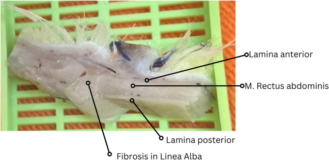 A reproducible rat model for predicting incisional hernia recurrence: insights for clinical translation.