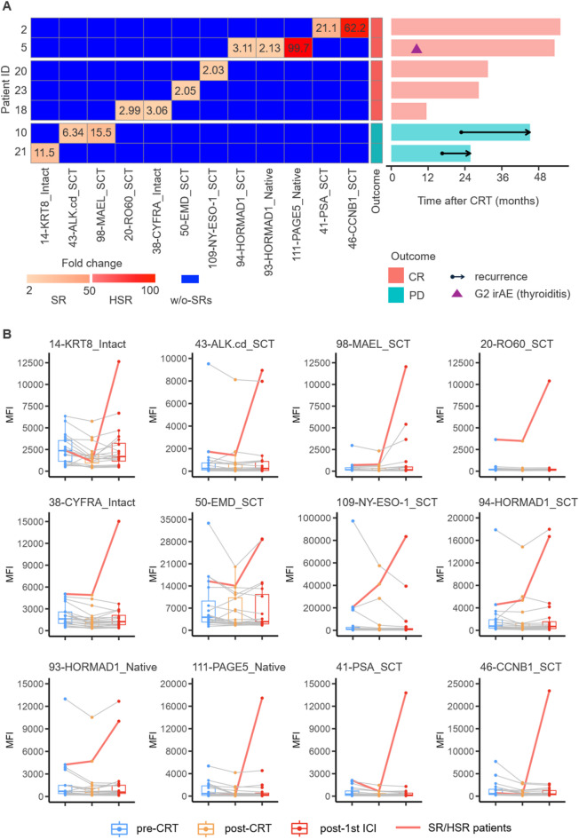 Autoantibody spark response predicts treatment outcome in patients receiving chemoradiation followed by durvalumab therapy.