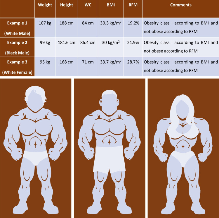 Relative Fat Mass: Refining Adiposity Measurement in the Era Beyond Body Mass Index.