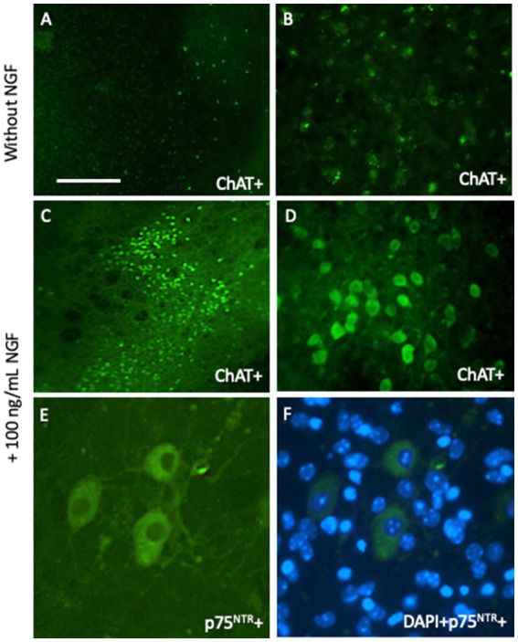 Three-dimensional organotypic mouse brain slices to study Alzheimer's disease pathologies: a review.