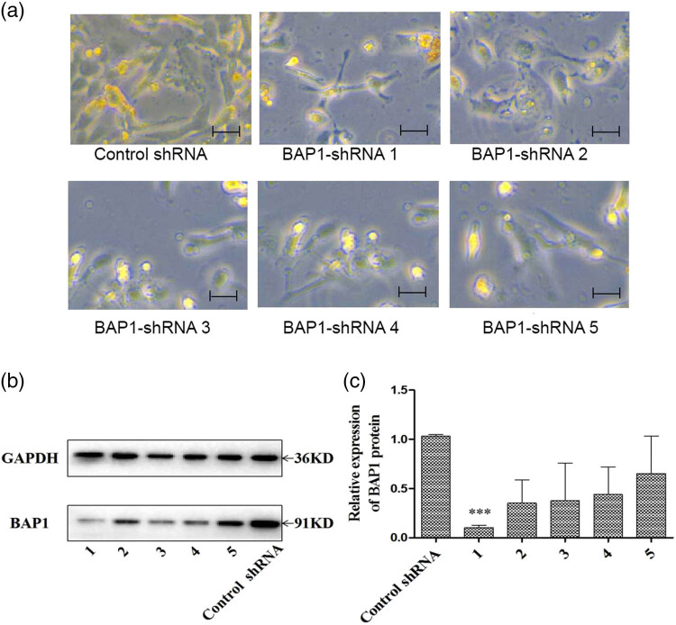 BAP1 complexes with YY1 and RBBP7 and its downstream targets in ccRCC cells.