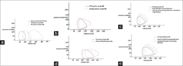 Perioperative challenges and management strategies for non-cardiac surgery in patients with rheumatic heart diseases: A narrative review.