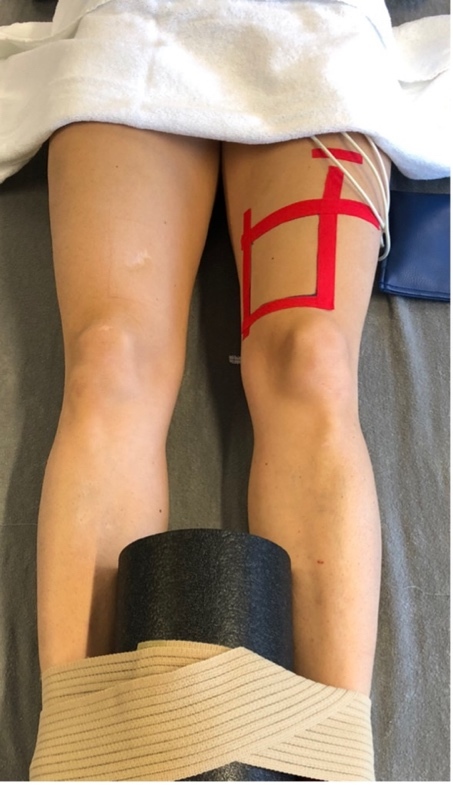 Physiological Effects of Local Theragun™ Application: An Observational Study in Healthy Female Participants.