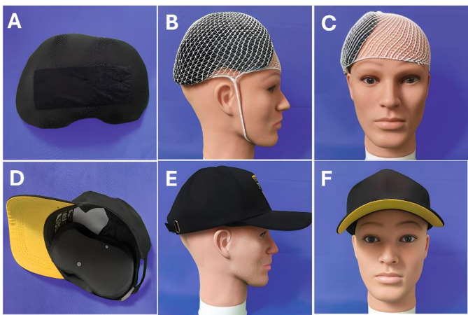 A personalized 3D printed cranial shield using mirror-image modeling: design and clinical assessment.