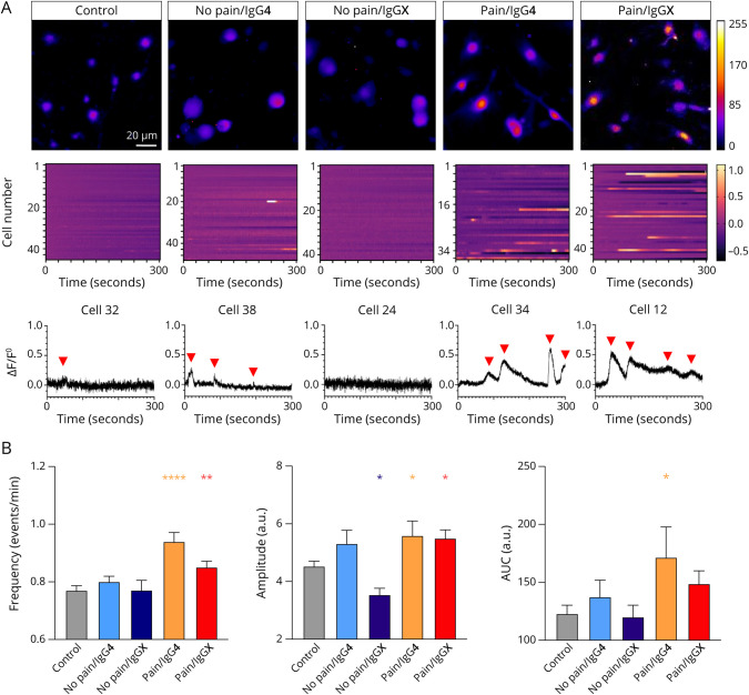 Neuropathic Pain and Distinct CASPR2 Autoantibody IgG Subclasses Drive Neuronal Hyperexcitability.