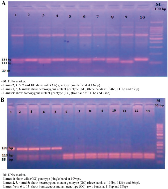 Contribution of TP53 and MDM4 Genetic Polymorphisms as a Risk Factor in Non-Hodgkin Lymphoma in Adult Egyptian Patients.