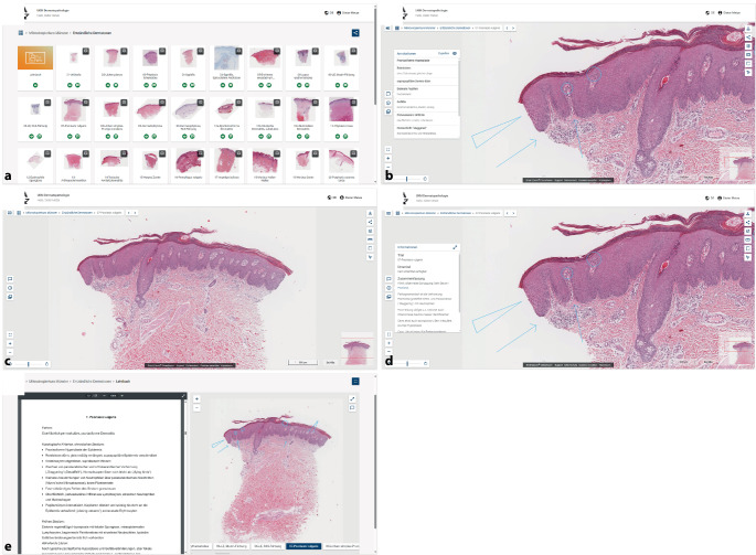 [Training in the age of digitalization- evaluation of the digital Münster dermatopathology course].