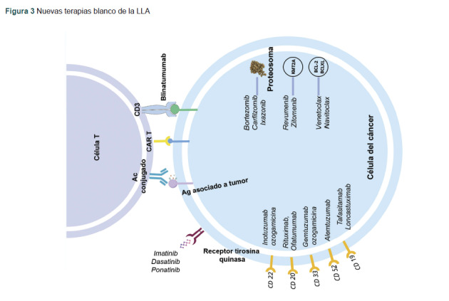 [Diagnosis and treatment of pediatric acute lymphoblastic leukemia: Historical review].