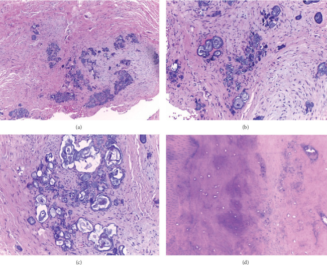 Generalized Odontodysplasia: A Case Report of the Oldest Reported Patient.