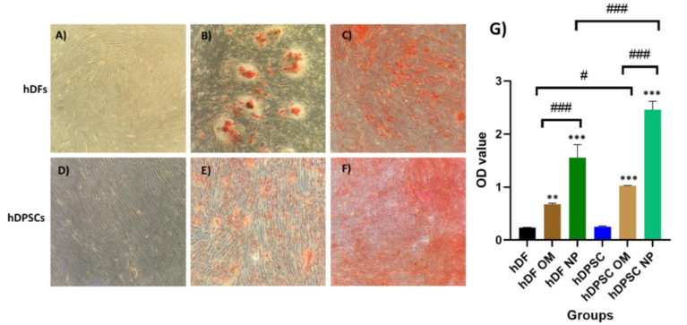 Osteogenic potential of human dental pulp stem cells, and human dermal fibroblasts exposed hydroxyapatite nanoparticles: A comparative in vitro study.