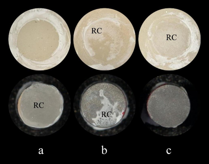 In vitro shear bond strength evaluation of resin cements between zirconia and titanium.