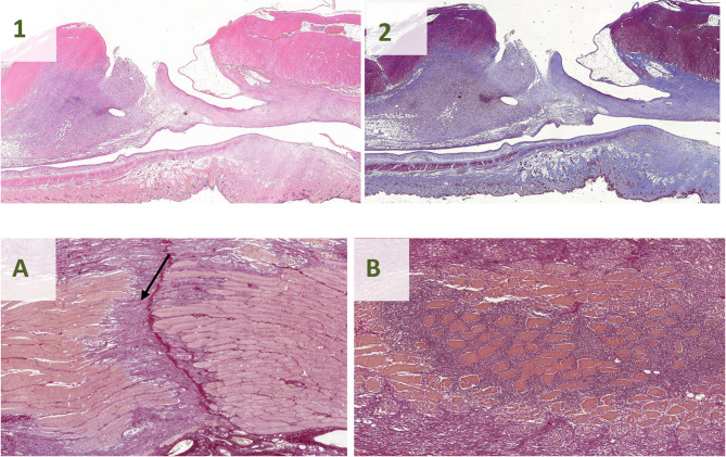 A reproducible rat model for predicting incisional hernia recurrence: insights for clinical translation.