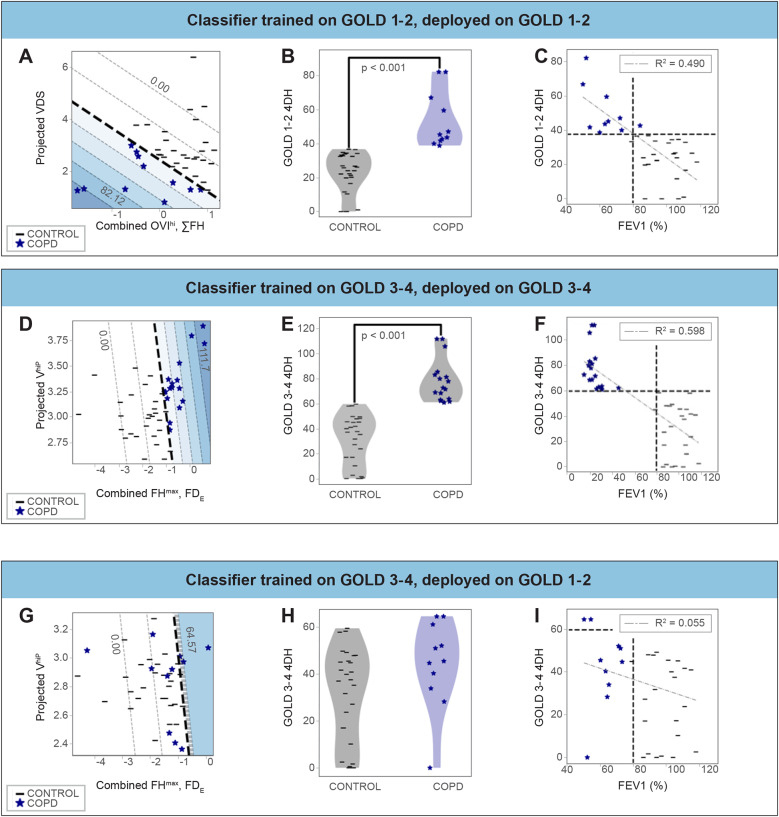X-ray velocimetry provides temporally and spatially-resolved biomarkers of lung ventilation in small airways disease.