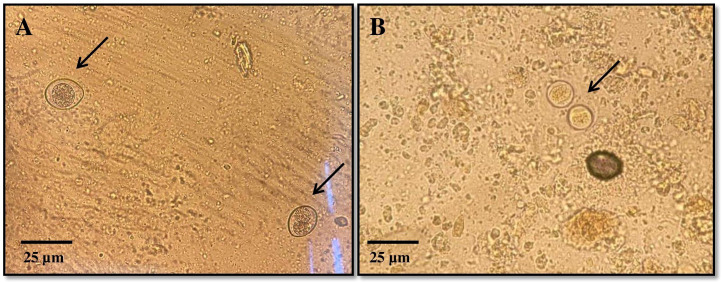 Molecular genetic characterization of <i>Cryptosporidium</i> and <i>Cystoisospora</i> protozoan infections in cats from large cities of Kazakhstan.