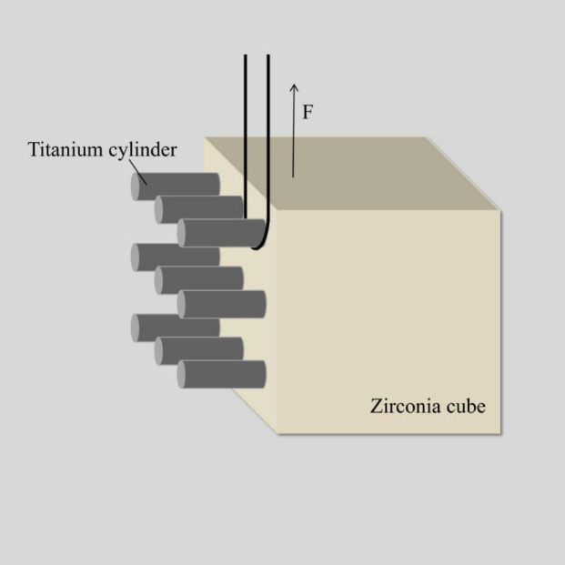 In vitro shear bond strength evaluation of resin cements between zirconia and titanium.