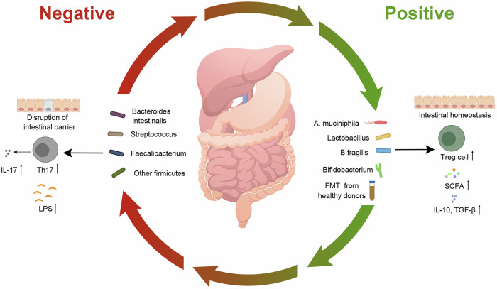Gut microbiota shapes cancer immunotherapy responses.