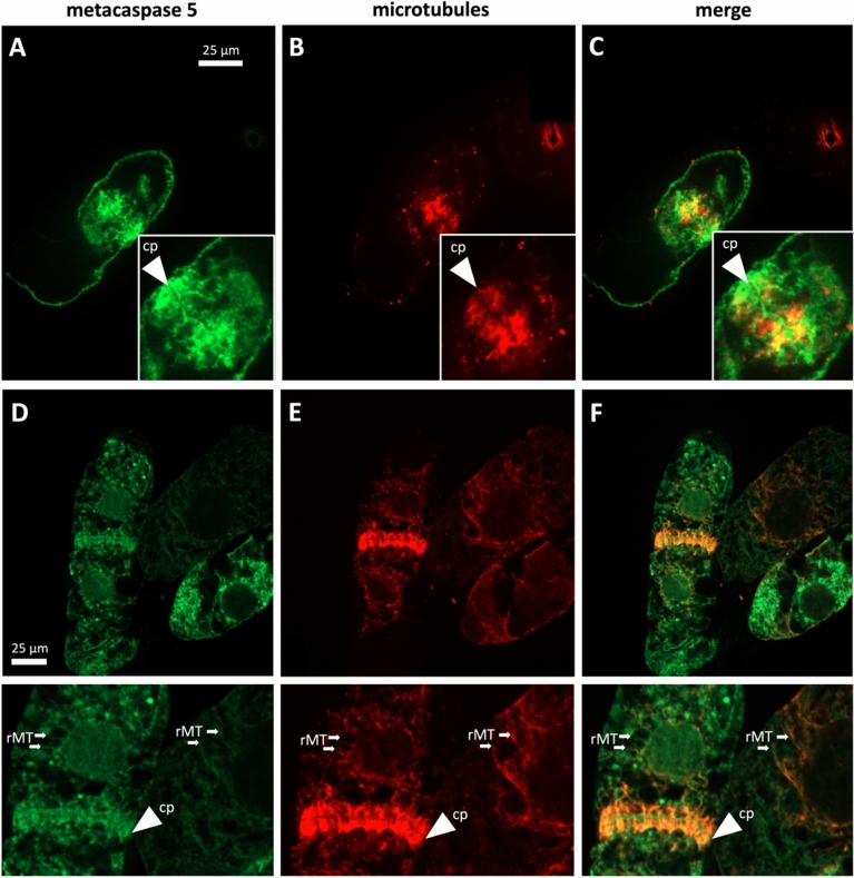 Unleash the dogs of death: metacaspase 5, microtubules, and hypersensitive response.