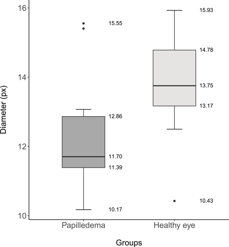 Retinal Vessel Oxygen Saturation in Patients with Unilateral Edema of the Optic Nerve Head: A Pilot Study.