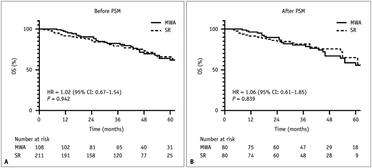 Microwave Ablation Versus Surgical Resection for Small (≤3 cm) Hepatocellular Carcinoma in Older Patients: A Propensity Score Matching Analysis.