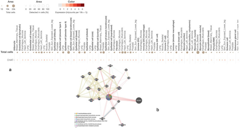 The identification of novel missense variant in <i>ChAT</i> gene in a patient with gestational diabetes denotes plausible genetic association.