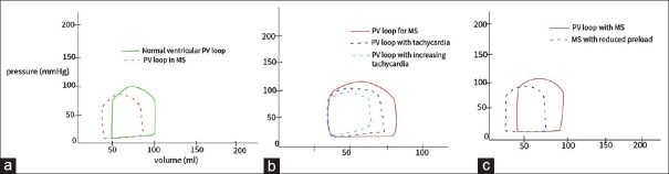 Perioperative challenges and management strategies for non-cardiac surgery in patients with rheumatic heart diseases: A narrative review.