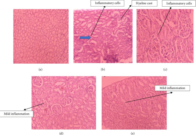 Nephroprotection of Wood Apple (<i>Limonia acidissima</i>), Water Spinach (<i>Ipomoea aquatica</i>), and Moringa (<i>Moringa oleifera</i>) on Gentamicin-Induced Nephrotoxicity and Oxidative Stress in Rat Model.