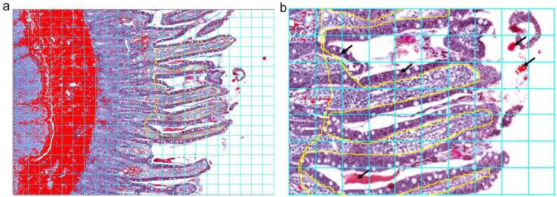 Quantitative assessment of mucosal fibrosis and its correlation with disease severity and outcome in cats with chronic enteropathy.
