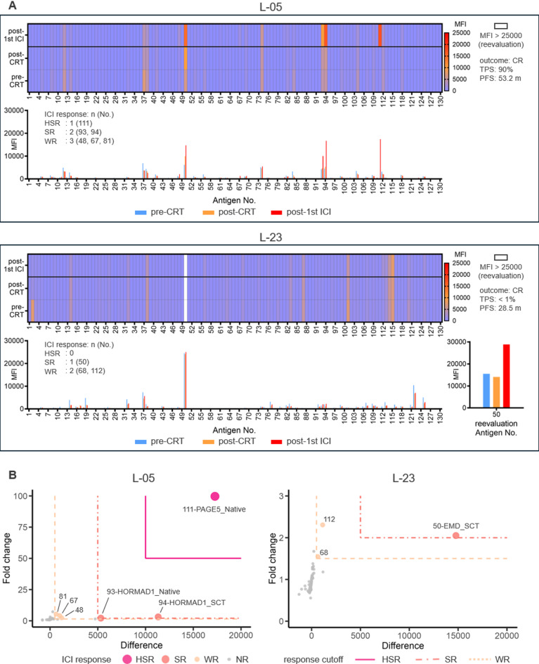 Autoantibody spark response predicts treatment outcome in patients receiving chemoradiation followed by durvalumab therapy.