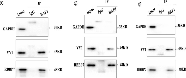 BAP1 complexes with YY1 and RBBP7 and its downstream targets in ccRCC cells.