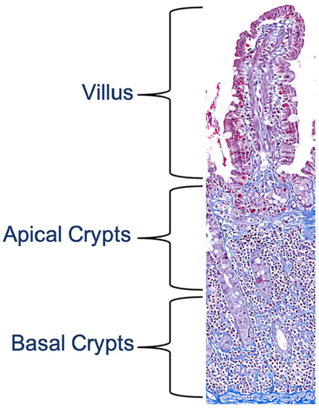 Quantitative assessment of mucosal fibrosis and its correlation with disease severity and outcome in cats with chronic enteropathy.