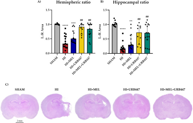 Neuroprotective effect of the combination therapy of melatonin and URB447 after neonatal hypoxia-ischemia.