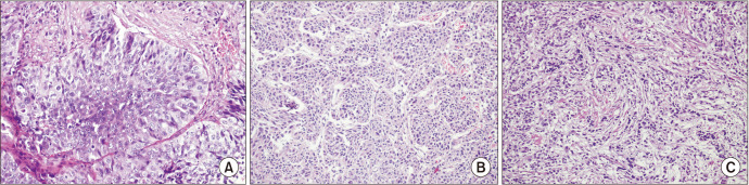 Predictive value of tumor invasion patterns on intravesical bacillus Calmette-Guérin response for stage T1 high-grade non-muscle-invasive bladder cancer.