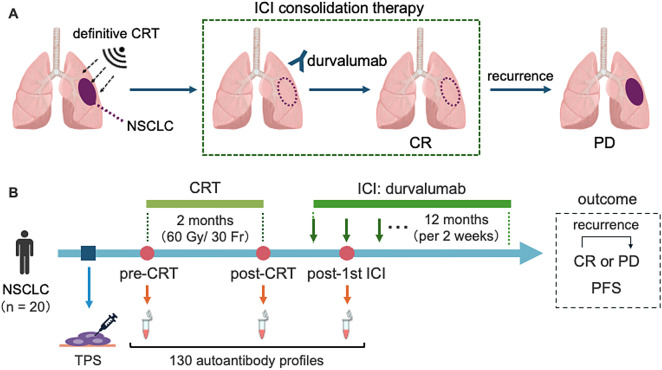 Autoantibody spark response predicts treatment outcome in patients receiving chemoradiation followed by durvalumab therapy.