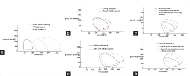 Perioperative challenges and management strategies for non-cardiac surgery in patients with rheumatic heart diseases: A narrative review.
