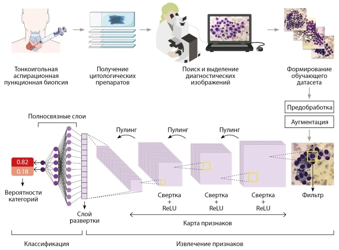 [Prospects for the application of convolutional neural networks in the cytological diagnosis of thyroid nodules].