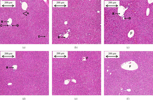 Daily Supplementation of High Doses of Tocotrienol-Rich Fraction From Palm Oil Produced No Toxic Effects in Healthy Mice.