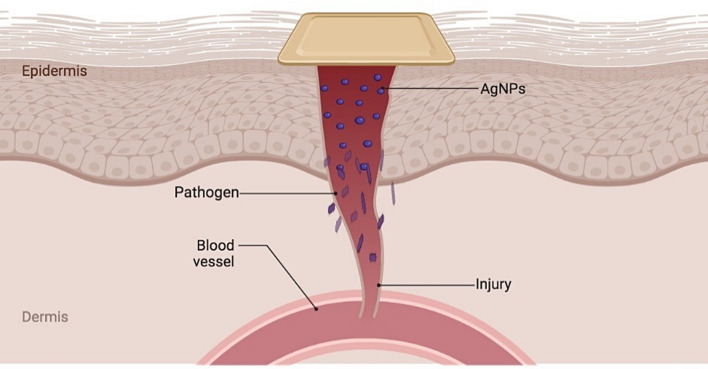 Biodegradable chitosan/PVA-based hydrogel incorporating green synthesized silver nanoparticles for wound healing applications.