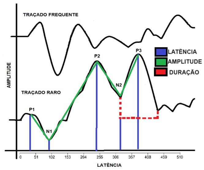 Response time, amplitude, and neural auditory maintenance in individuals with tinnitus: a comparative study.