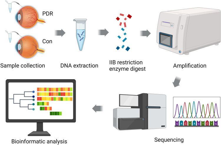 Characterization of Vitreous Microbiota Dysbiosis Associated with Proliferative Diabetic Retinopathy.