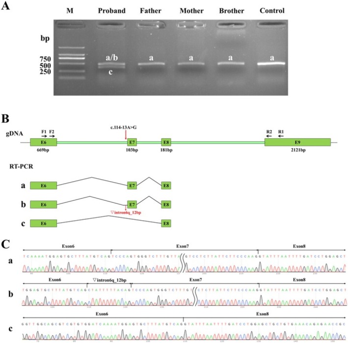 A Novel Intronic Mutation in MBD5 Results in Autosomal Dominant Intellectual Disability Type 1 due to Abnormal Splicing.