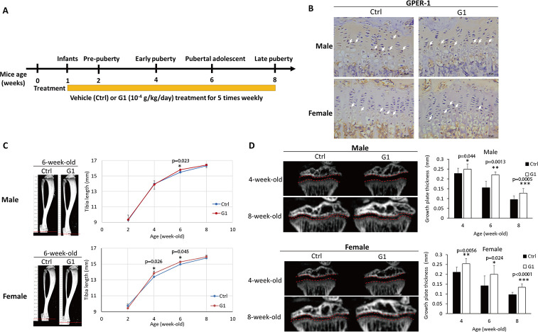 G-protein-coupled estrogen receptor-1 facilitates chondrocyte proliferation in pubertal epiphyseal growth plate via PTHrP/Ihh regulation.