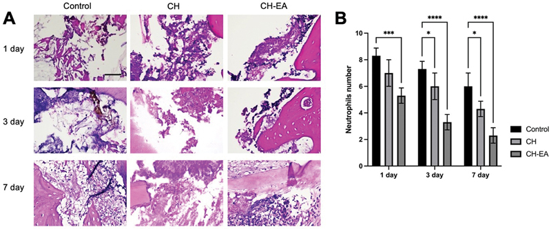 Anti-Inflammatory Effects of Calcium Hydroxide Combined with Ellagic Acid as Pulp Capping Material: In Vivo Study.