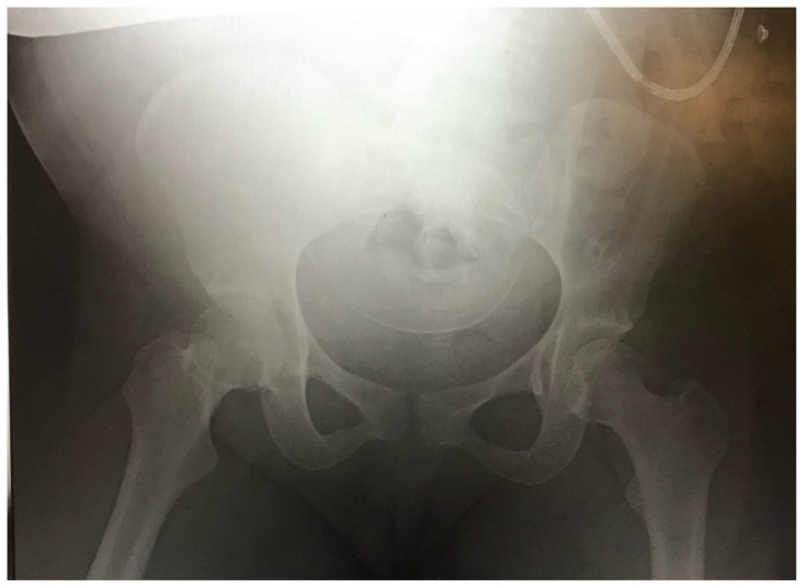Critical Care Transport: Blunt Polytrauma in Pregnancy.