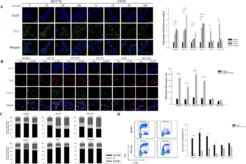 Cyclin dependent kinase 9 inhibitor induces transcription-replication conflicts and DNA damage accumulation in breast cancer.