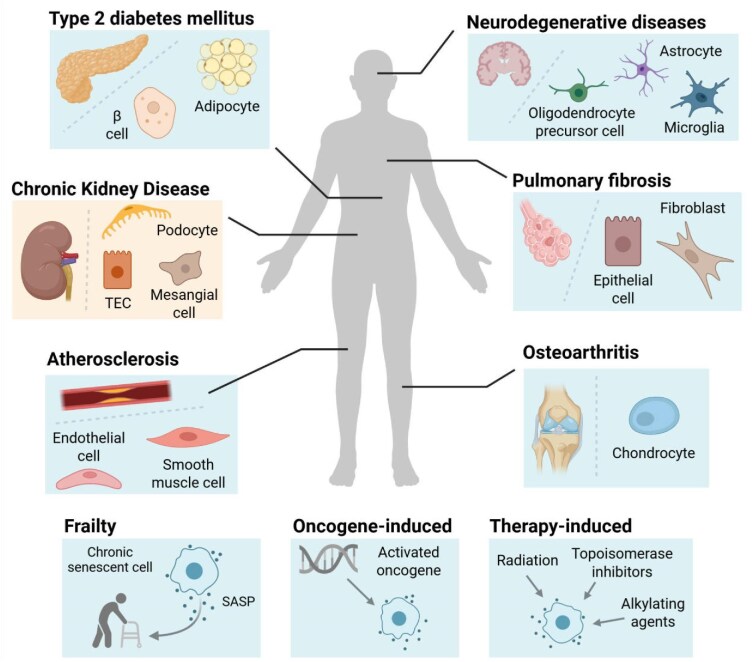 Understanding and targeting senescence in kidney disease.