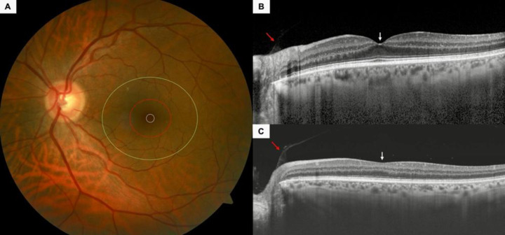 Clinical anatomy of the macula.