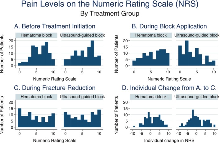 Ultrasound-Guided Nerve Blocks Improve Success Rate of Closed Reduction of Colles' Fractures: A Randomised Controlled Trial.