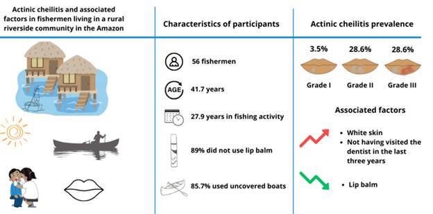 Actinic cheilitis and associated factors in fishermen living in a rural riverside community in the Amazon.