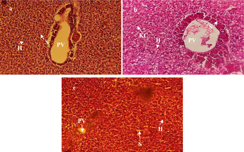 Methimazole-induced reproductive endocrine system disruption and hepatotoxicity: insights from a Trichogaster trichopterus animal model.