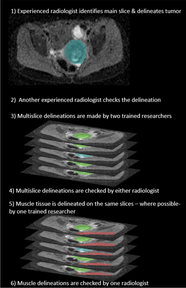 Acquisition matters - how do scan parameters affect apparent diffusion coefficient estimates in pediatric rhabdomyosarcoma.